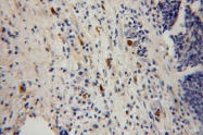 13333-1-AP - Hexokinase-3