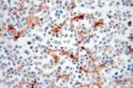 15777-1-AP - HLA class I Cw7 alpha / HLA-C