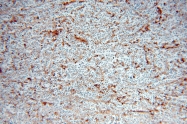 15777-1-AP - HLA class I Cw7 alpha / HLA-C
