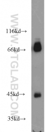 15777-1-AP - HLA class I Cw7 alpha / HLA-C