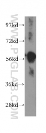 11838-1-AP - HLA class II DM alpha / HLA-DMA