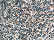 11298-1-AP - HLA class II DP beta 1 / HLA-DPB1