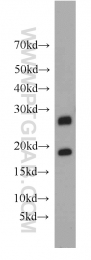 55072-1-AP - HLA-DQA2