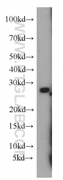 55072-1-AP - HLA-DQA2