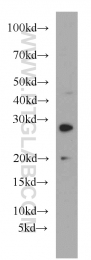 55072-1-AP - HLA-DQA2