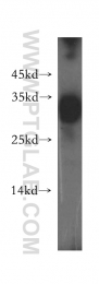 15862-1-AP - HLA class II DR beta 1 / HLA-DRB1