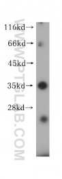 15733-1-AP - HLA Class II DR beta 4 / HLA-DRB4