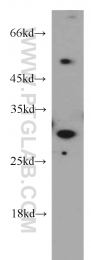21702-1-AP - HLA class II DRB5 beta / HLA-DRB5