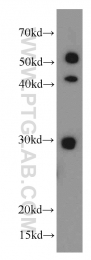 21702-1-AP - HLA class II DRB5 beta / HLA-DRB5