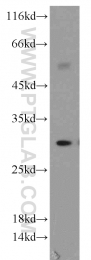 21702-1-AP - HLA class II DRB5 beta / HLA-DRB5