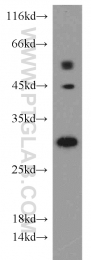 21702-1-AP - HLA class II DRB5 beta / HLA-DRB5