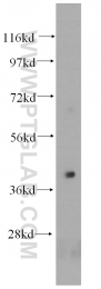 15008-1-AP - HLA class I alpha E / HLA-E