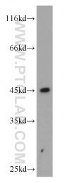 14670-1-AP - HLA class I alpha F / HLA-F