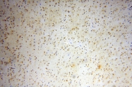 14597-1-AP - HMGB2 / HMG2