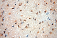 14597-1-AP - HMGB2 / HMG2