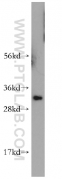 14597-1-AP - HMGB2 / HMG2