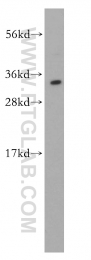 14597-1-AP - HMGB2 / HMG2