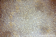 15605-1-AP - HMGB2 / HMG2