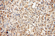15605-1-AP - HMGB2 / HMG2