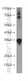 15605-1-AP - HMGB2 / HMG2