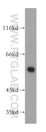 17643-1-AP - HMG-CoA synthase / HMGCS