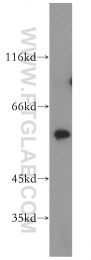17643-1-AP - HMG-CoA synthase / HMGCS