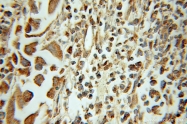 10953-1-AP - HMGN2 / HMG17