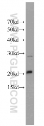 10953-1-AP - HMGN2 / HMG17