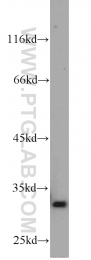 10701-1-AP - Heme oxygenase 1 / HMOX1