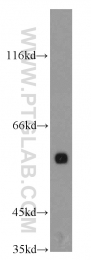12533-1-AP - HNF1 beta / TCF2