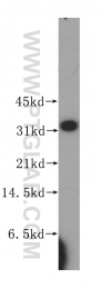 11874-1-AP - HNMT / HMT