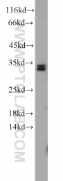 10848-1-AP - hnRNP-A0 / HNRPA0