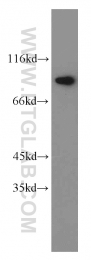 10871-1-AP - HOOK1