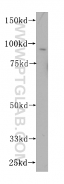 10871-1-AP - HOOK1