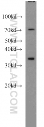 55495-1-AP - HOXA11 / HOX1I