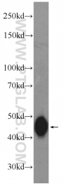 18501-1-AP - HOXA9 / HOX1G