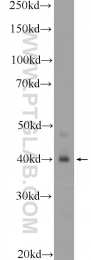 18501-1-AP - HOXA9 / HOX1G