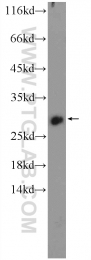 12613-1-AP - HOXB7 / HOX2C