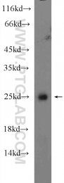 12613-1-AP - HOXB7 / HOX2C