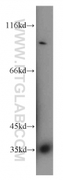 18736-1-AP - HOXD13 / HOX4I