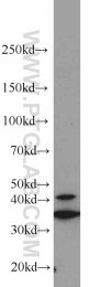 18736-1-AP - HOXD13 / HOX4I