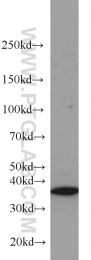 18736-1-AP - HOXD13 / HOX4I