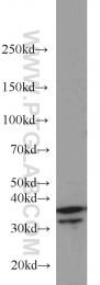 18736-1-AP - HOXD13 / HOX4I