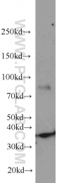 18736-1-AP - HOXD13 / HOX4I
