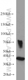 18736-1-AP - HOXD13 / HOX4I