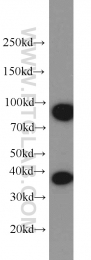 18736-1-AP - HOXD13 / HOX4I