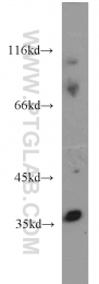 18736-1-AP - HOXD13 / HOX4I