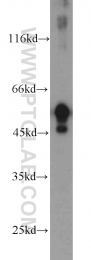 18736-1-AP - HOXD13 / HOX4I