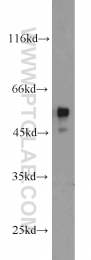 18736-1-AP - HOXD13 / HOX4I