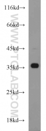 18736-1-AP - HOXD13 / HOX4I